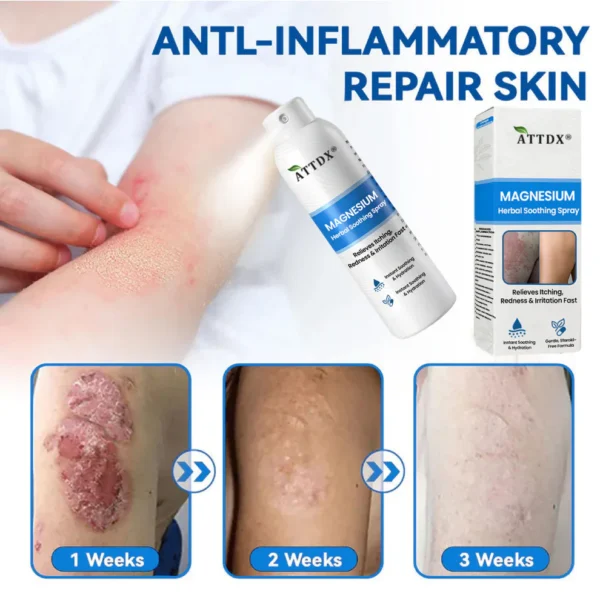 ATTDX® Magnesium Herbal Soothing Spray