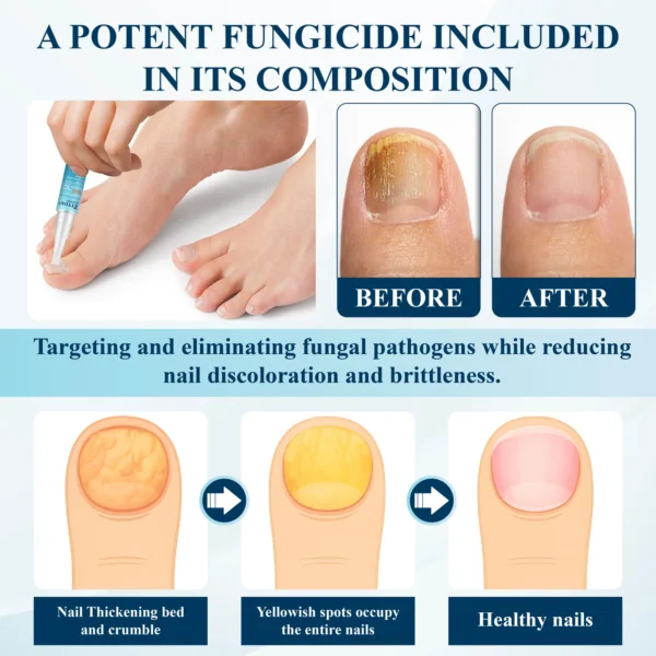 ATTDX® MycoStop Nail Recovery Serum Pen - Image 6