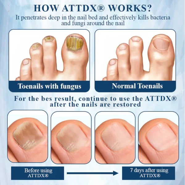 ATTDX® MycoStop Nail Recovery Serum Pen - Image 8