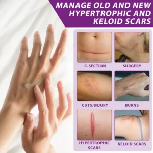 ATTDX® ClearScar Advanced Therapy Spray image ATTDX® ClearScar Advanced Therapy Spray