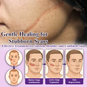 ATTDX® ClearScar Advanced Therapy Spray image ATTDX® ClearScar Advanced Therapy Spray