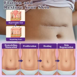 ATTDX® ClearScar Advanced Therapy Spray image ATTDX® ClearScar Advanced Therapy Spray