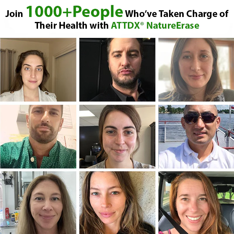 ATTDX® NatureErase Instant Alligator Oil Mole & Spot Cream