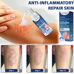 ATTDX® PsoriEase Magnesium Healing Foam