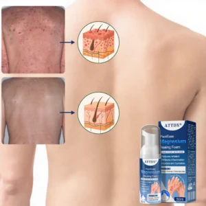 ATTDX® PsoriEase Magnesium Healing Foam