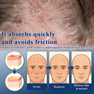 ATTDX® PsoriEase Magnesium Healing Foam