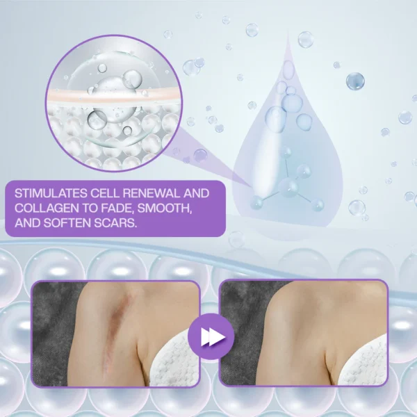 ATTDX® RevivaDerma Face & Body Scar Gel