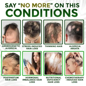 flysmus® Microneedle Herbal Infusion Hair Stimulation Set image flysmus® Microneedle Herbal Infusion Hair Stimulation Set