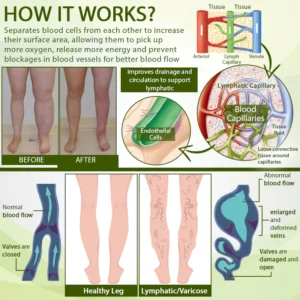ATTDX® SwellSoothe Lymphatic Cream