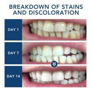 ATTDX® Laser Smile Care Device
