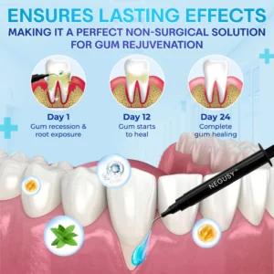 Negusy™ Gum Therapy Agent image Negusy™ Gum Therapy Agent