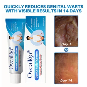 Oveallgo® HPV Genital Warts Relief Cream image Oveallgo® HPV Genital Warts Relief Cream