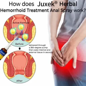 Juxek® Herbal Hemorrhoid Treatment Anal Spray Pro