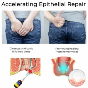 Juxek® Herbal Hemorrhoid Treatment Anal Spray Pro Juxek® Herbal Hemorrhoid Treatment Anal Spray Pro