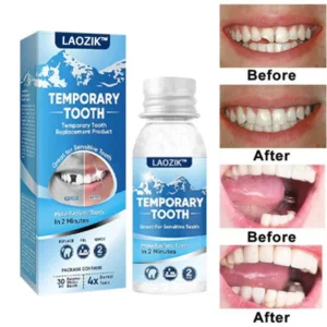 LAOZIK™ Dental Filling Gel – Pain-Free, Drill-Free Cavity Solution