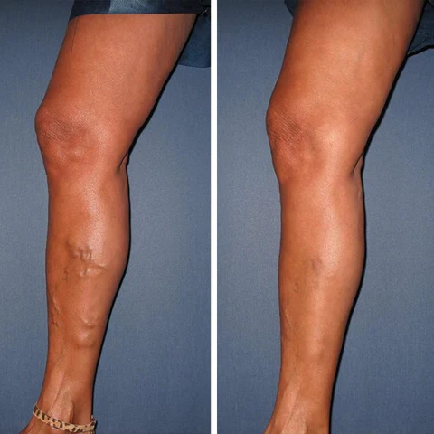 Oveallgo™ VeinCare MagAcupoint Reflexology Insole image Oveallgo™ VeinCare MagAcupoint Reflexology Insole