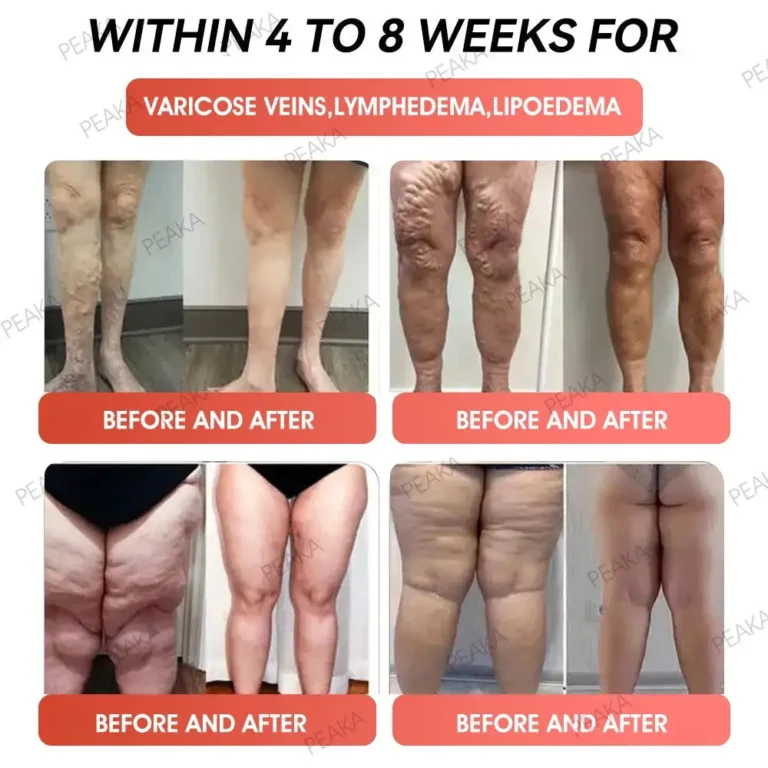 PEAKA® GLP-1 Natural Happy Estrogen