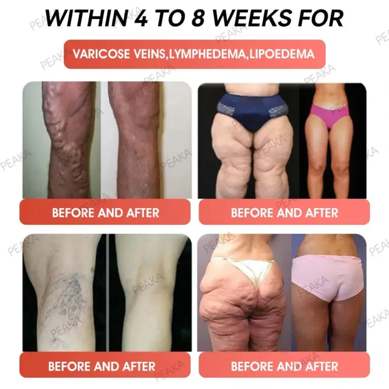 PEAKA® GLP-1 Natural Happy Estrogen