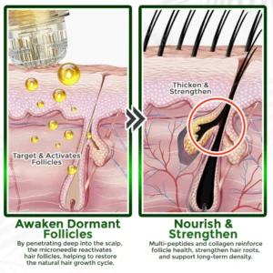 flysmus® Microneedle Herbal Infusion Hair Stimulation Set image flysmus® Microneedle Herbal Infusion Hair Stimulation Set