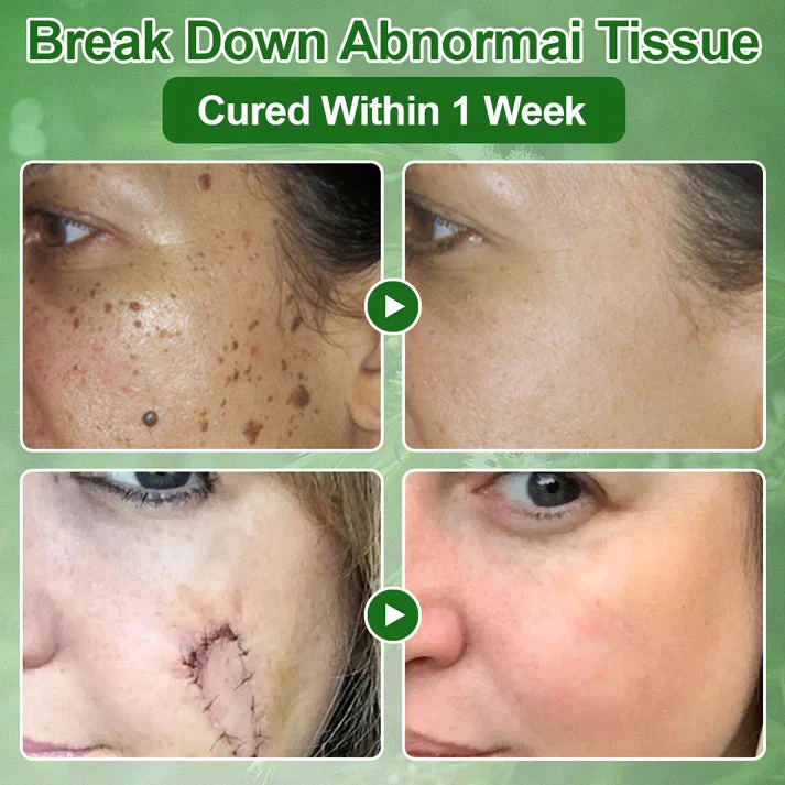 AEXZR® Tea Tree Oil Skin Treatment Cream image AEXZR® Tea Tree Oil Skin Treatment Cream