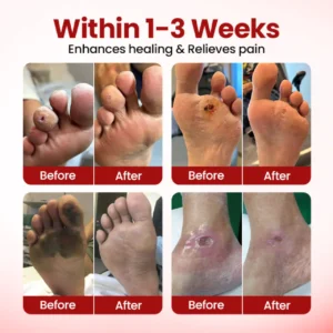 Timilk® VitaGluco Diabetic Care Cream image Timilk® VitaGluco Diabetic Care Cream