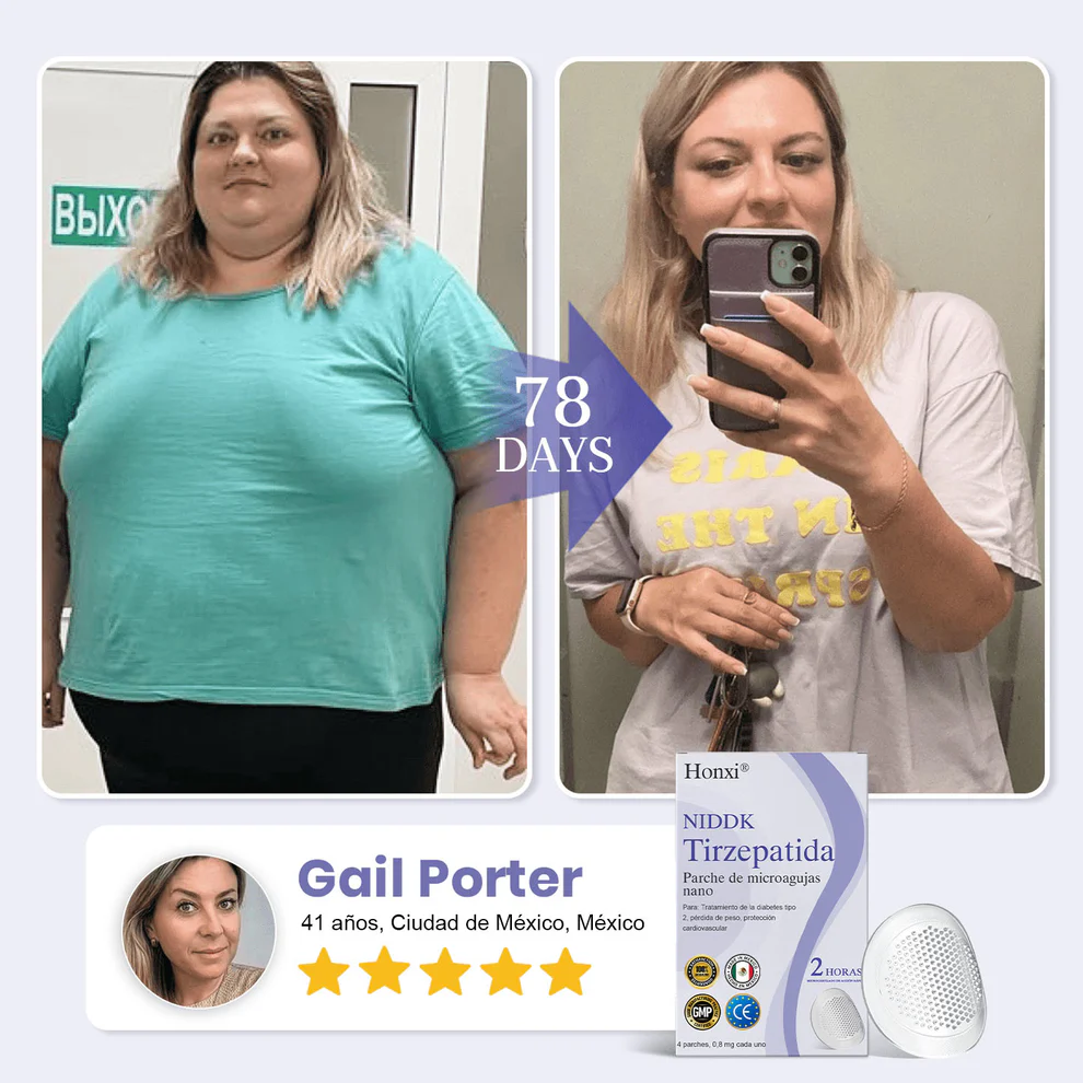 ๐๐ผ๐ป๐
๐ถยฎ NIDDK-Tirzepatide Nano Microneedle Patch 3 ๐๐ผ๐ป๐
๐ถยฎ NIDDK-Tirzepatide Nano Microneedle Patch