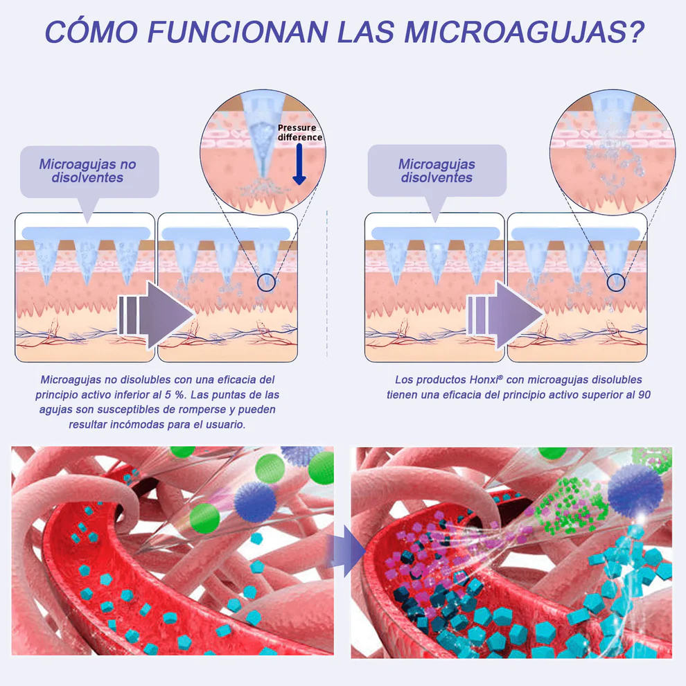 ๐๐ผ๐ป๐
๐ถยฎ NIDDK-Tirzepatide Nano Microneedle Patch 9 ๐๐ผ๐ป๐
๐ถยฎ NIDDK-Tirzepatide Nano Microneedle Patch