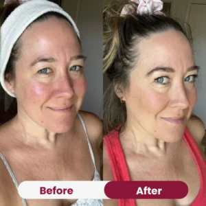 Anti-Wrinkle Collagen Mask