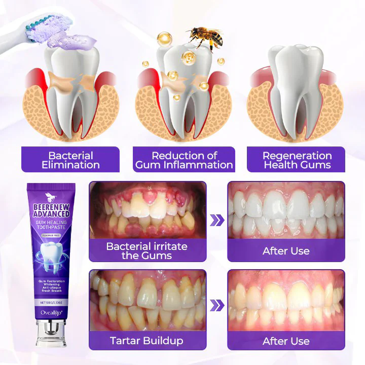 Oveallgo® BeeRenew Advanced Gum Healing Toothpaste 4 Oveallgo® BeeRenew Advanced Gum Healing Toothpaste