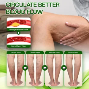 Timilk® SwellRelief Horse Chestnut Edema Cream 18 Timilk® SwellRelief Horse Chestnut Edema Cream