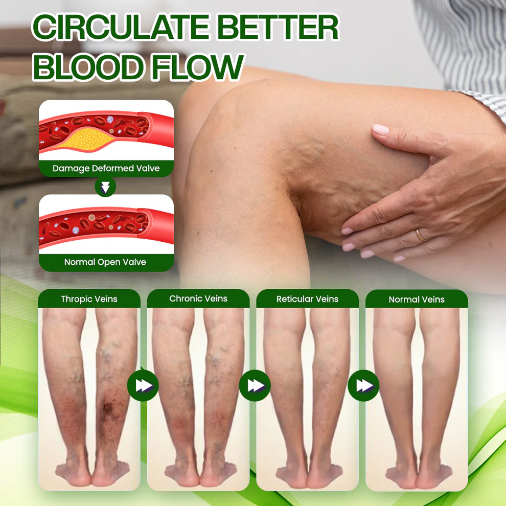 Timilk® SwellRelief Horse Chestnut Edema Cream 7 Timilk® SwellRelief Horse Chestnut Edema Cream