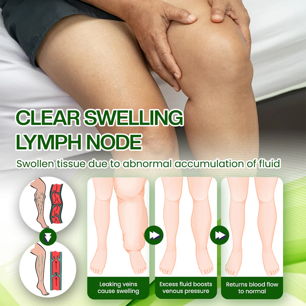 Timilk® SwellRelief Horse Chestnut Edema Cream 8 Timilk® SwellRelief Horse Chestnut Edema Cream