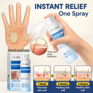 Oveallgo® Magnesium Herbal Psoriasis Spray 17 Oveallgo® Magnesium Herbal Psoriasis Spray