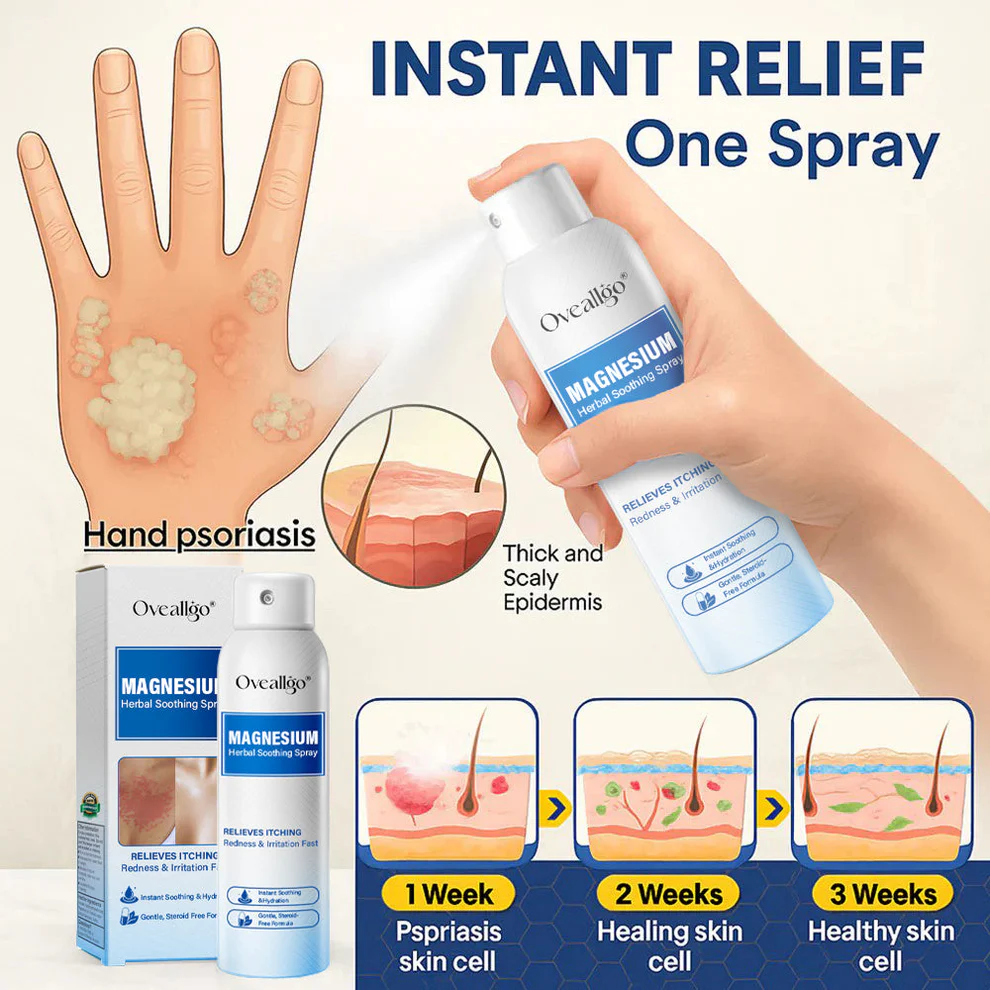 Oveallgo® Magnesium Herbal Psoriasis Spray 7 Oveallgo® Magnesium Herbal Psoriasis Spray
