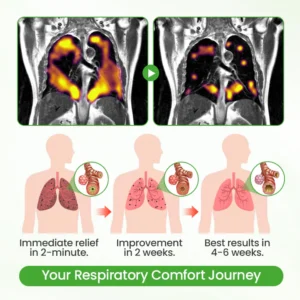 Cvreoz® HerbaAir Mullein Lung Purifier 15 Cvreoz® HerbaAir Mullein Lung Purifier