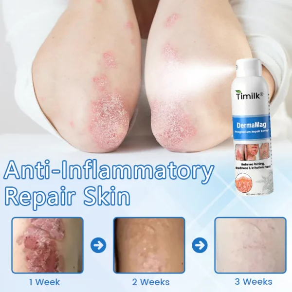 Timilk® DermaMag Magnesium Repair Spray