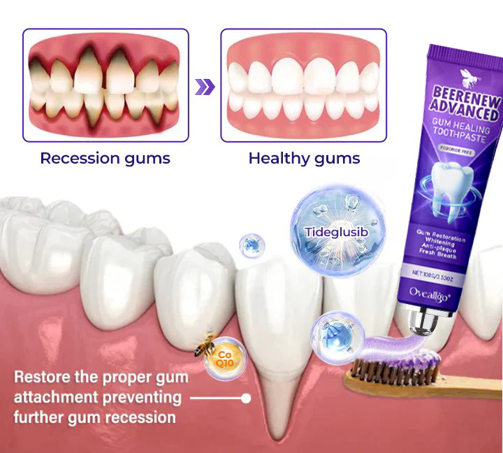 Oveallgo® BeeRenew Advanced Gum Healing Toothpaste 12 Oveallgo® BeeRenew Advanced Gum Healing Toothpaste