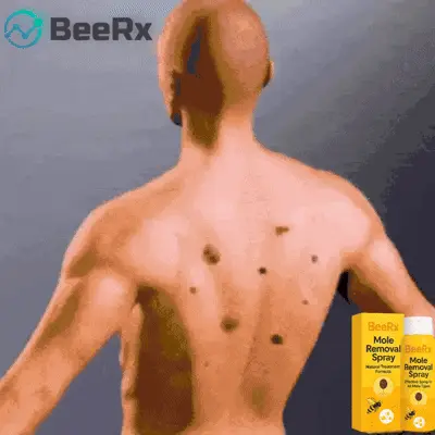BeeRx Mole Removal Spray image BeeRx Mole Removal Spray