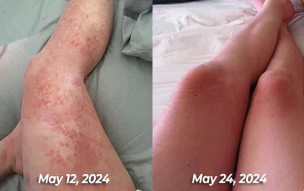 BBOJI™Bee venom Comprehensive Cream image BBOJI™Bee venom Comprehensive Cream