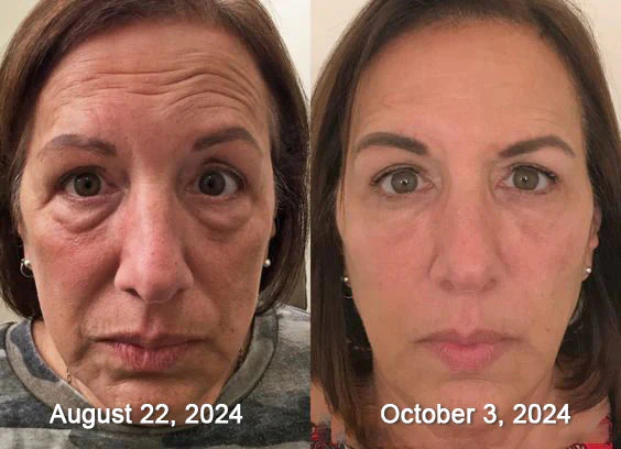 BBOJI™Bee venom Comprehensive Cream image BBOJI™Bee venom Comprehensive Cream