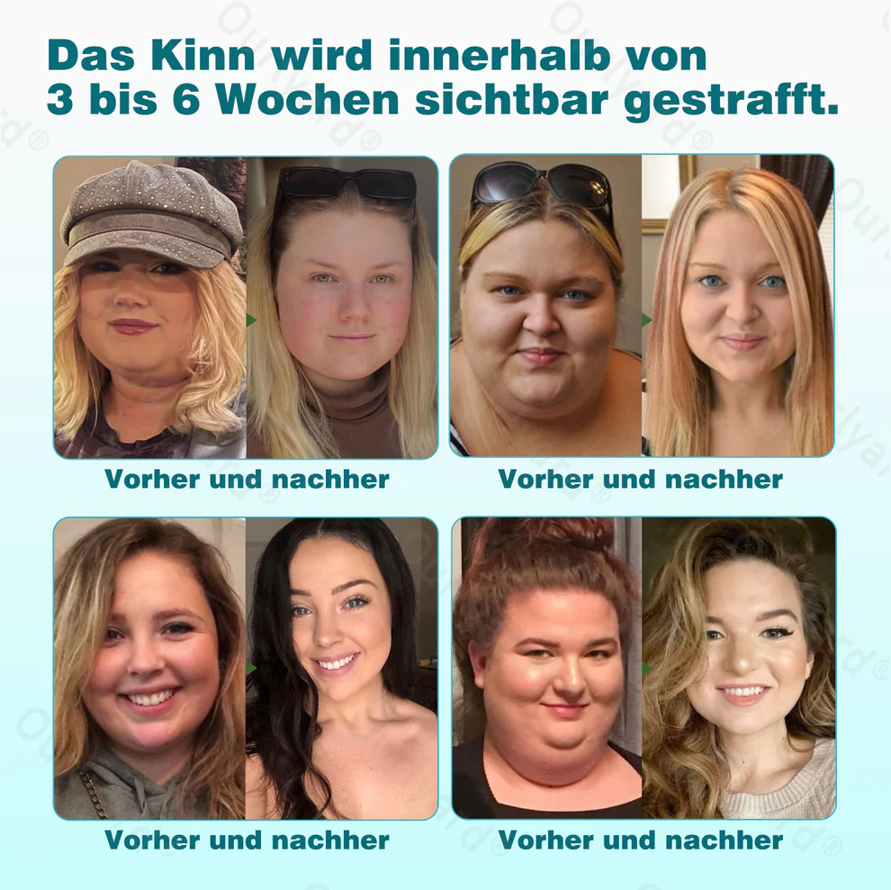 Ourlyardยฎ GIP + GLP-1 Microneedle Nanopatch 9 Ourlyardยฎ GIP + GLP-1 Microneedle Nanopatch