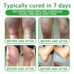 NovaRX® Advanced Magnesium & Emu Oil Massage Pain Relief Cream