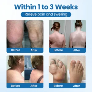 NovaRX® BPC-157 Joint Repair Cream image NovaRX® BPC-157 Joint Repair Cream