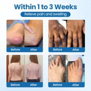 NovaRX® BPC-157 Joint Repair Cream image NovaRX® BPC-157 Joint Repair Cream