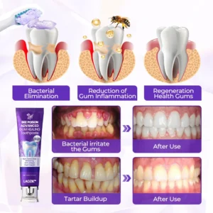 LAOZIK™ Bee Poison Advanced Gum Healing Toothpaste 13 LAOZIK™ Bee Poison Advanced Gum Healing Toothpaste