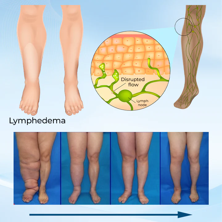 Timilk® LymphoEase Magnesium PCA Roll-On Relief Cream 2 Timilk® LymphoEase Magnesium PCA Roll-On Relief Cream
