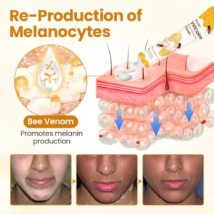 Timilk® VitiCalm Bee Venom Cream 12 Timilk® VitiCalm Bee Venom Cream