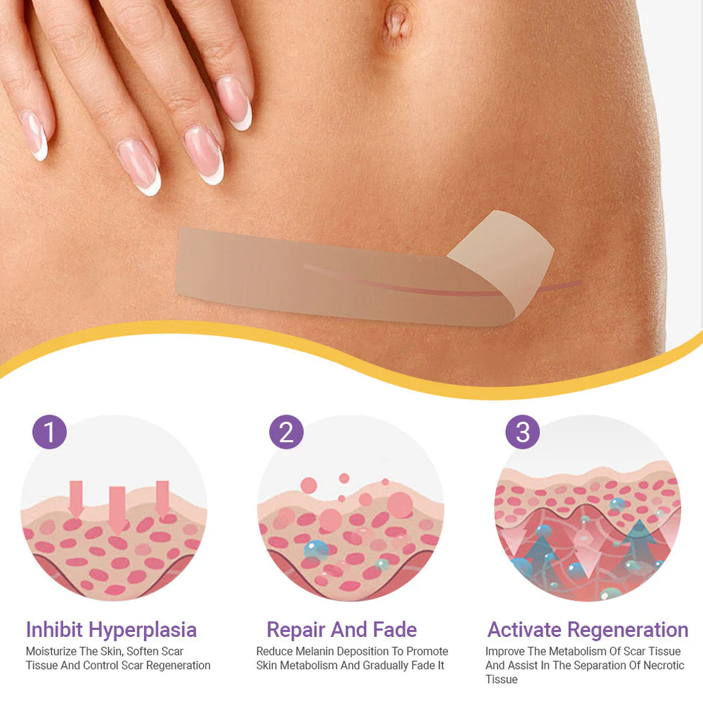 Oveallgo® Hyaluronic Acid Nano Microneedle Repair Tape image Oveallgo® Hyaluronic Acid Nano Microneedle Repair Tape