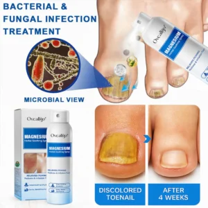 Oveallgo® Magnesium Herbal Psoriasis Spray 15 Oveallgo® Magnesium Herbal Psoriasis Spray