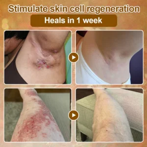 Ropceer® Tallow Honey Restoration Balm